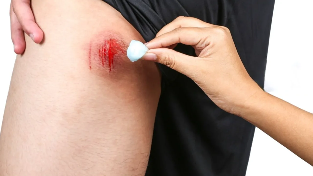 Rear End Auto Accidents attorney Philadelphia